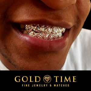 Yellow gold box trillion grillz worn on the upper teeth
