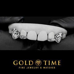 4-Piece Custom Grillz  Trillion Diamond-Cut with Diamond Dust Canines & Incisor Tips
