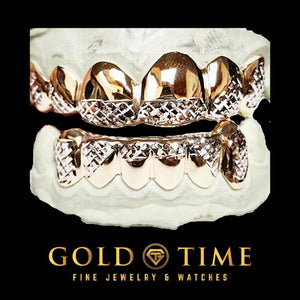 Top and bottom yellow grillz with white trillion diamond-cut tips