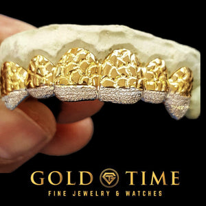 Custom yellow gold nugget grillz with diamond dust tips, larger set shown