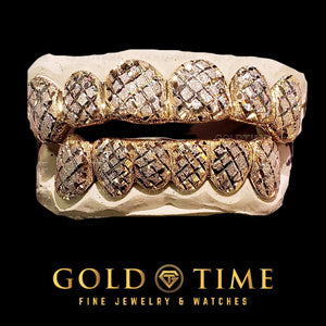 Two tone arctic cut diamond dust grillz, top and bottom sets, with deep trillion crosshatch texture