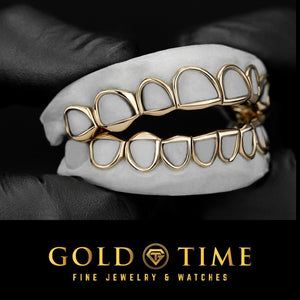 Angled view of yellow gold open face grillz top and bottom set fitted on a dental mold