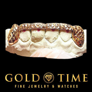 Close up of custom trillion cut grillz with diamond-cut texture
