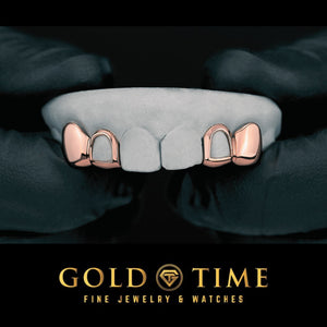 Rose gold 4 piece grillz with open face laterals and solid canines on a dental mold held in gloved hands, Gold Time