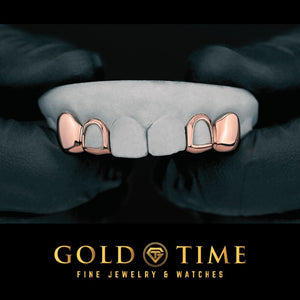 Rose gold solid canine and open face incisor double caps on both sides of a top dental mold