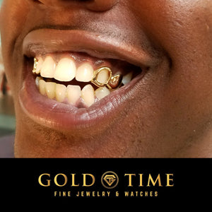 Smiling customer wearing yellow gold double cap grillz with solid canine and open face incisor on both sides