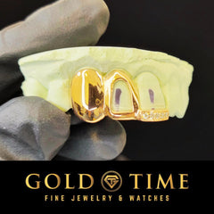 Custom 3-Piece Grillz Set: Solid, Open Face, Moissanite Tip - Includes Mold Kit