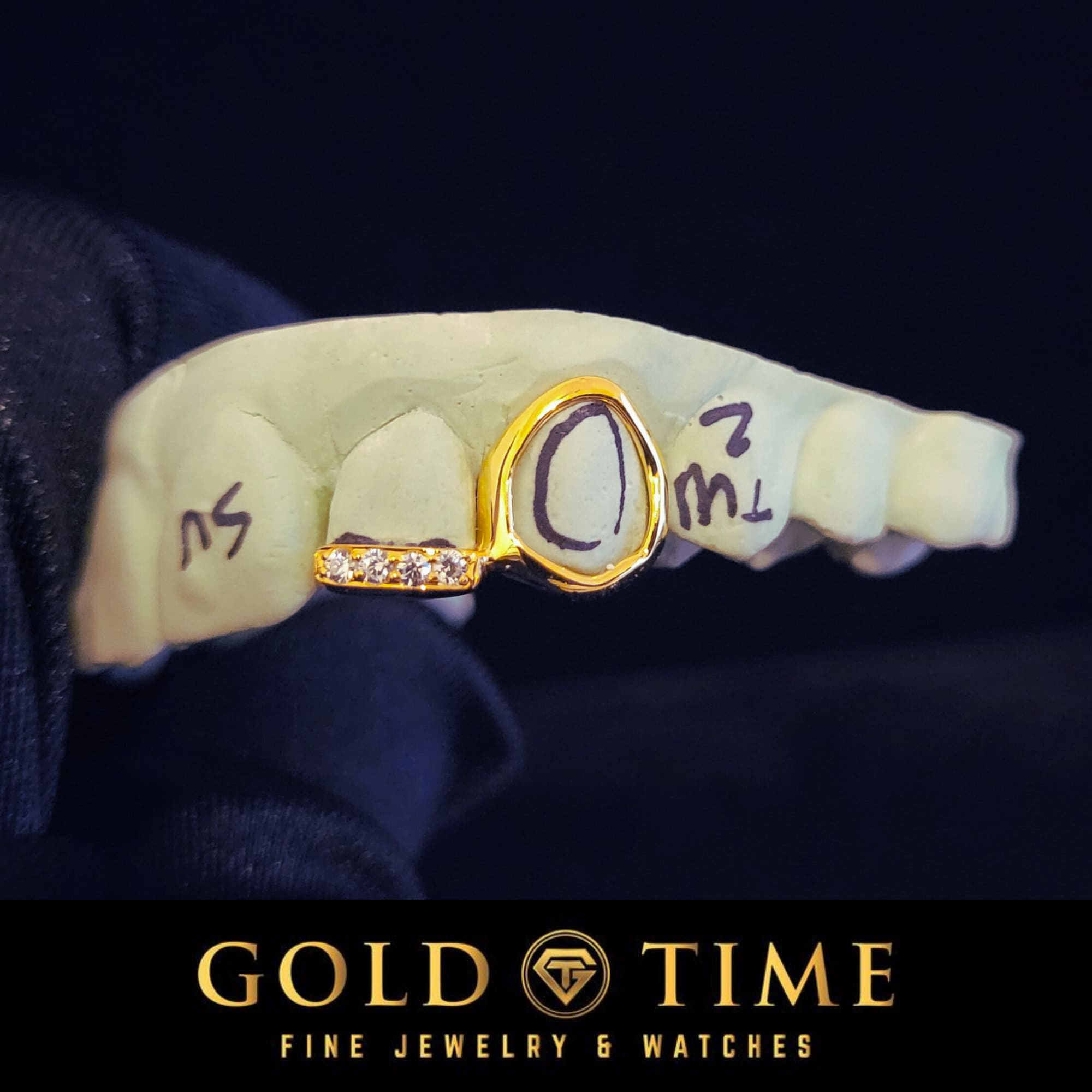 Custom Grillz: Open Face Canine & Moissanite Tip - Handmade Fit, Impression Kit