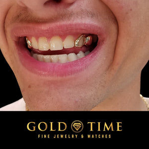 Gold open face and solid canine grillz worn in a smile, side view, Gold Time