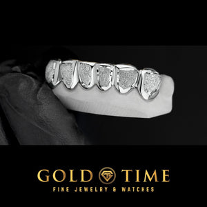Yellow gold diamond dust grillz set held in a hand, fitted to a dental mold
