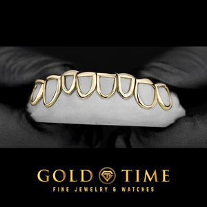 Gold open face grillz on a bottom dental mold held in gloved hands