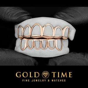 Rose gold open face grillz top and bottom set on a dental mold