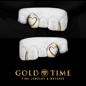 Top and bottom molds showing gold heart cut-out canine caps and gap bars
