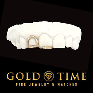 Yellow gold double cap grillz with a moissanite bordered open face canine and moissanite incisor tip on a dental mold