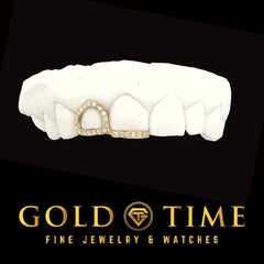 Custom Moissanite Diamond Grillz: Double Cap Open Face Canine, Incisor Tip