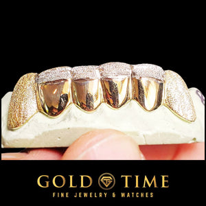 Rose gold grillz with diamond dust canines and dust tips on polished center teeth