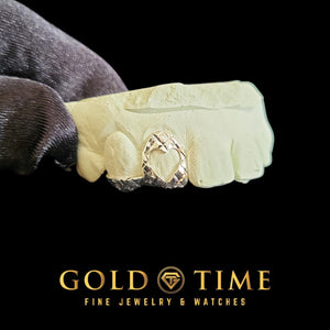 Custom yellow gold double cap grillz with open heart cut-out and trillion cut