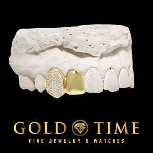 Yellow gold double cap grill with a solid lateral cap and an iced honeycomb moissanite canine cap on a dental mold, Gold Time