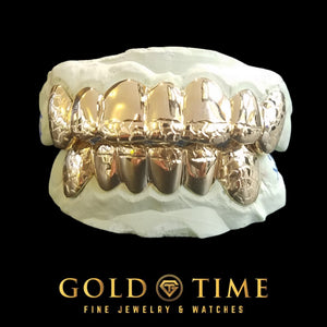 Yellow gold 12 piece top and bottom grill with nugget tips, canines, and bicuspids on a dental mold