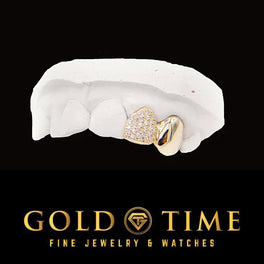 Yellow gold double cap grillz with a moissanite iced incisor and a solid canine cap on a dental mold