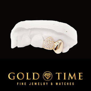 Yellow gold double cap grillz with a moissanite iced incisor and a solid canine cap on a dental mold