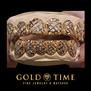 Front view of a two-tone yellow and white diamond dust grillz set, top and bottom