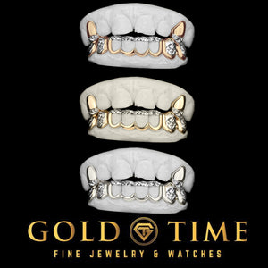 Three versions of the custom 10 piece open window grillz on dental molds, two in yellow gold with white diamond-cut details and one in all white metal