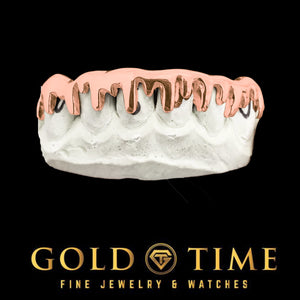 Custom rose gold 8 piece melting drip grillz on a mold