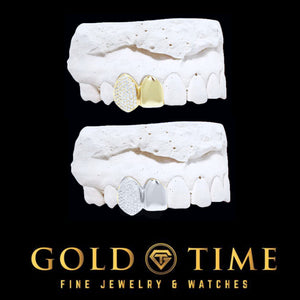 Custom double cap grillz on dental molds in yellow and white metal, a solid polished lateral cap beside a fully iced honeycomb moissanite canine cap, Gold Time