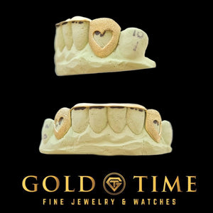 Yellow gold 6 piece grillz with heart cut out canines and a polished tip bar, two views on a lower dental mold, Gold Time