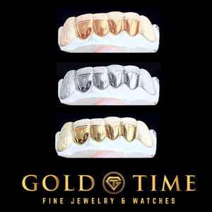 Diamond dust canine grillz in rose, white, and yellow gold