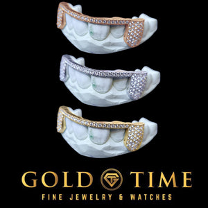 Bust down honeycomb moissanite grillz shown in rose, white and yellow finishes on dental molds