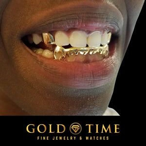 Smiling customer wearing custom yellow gold heart fang drip grillz