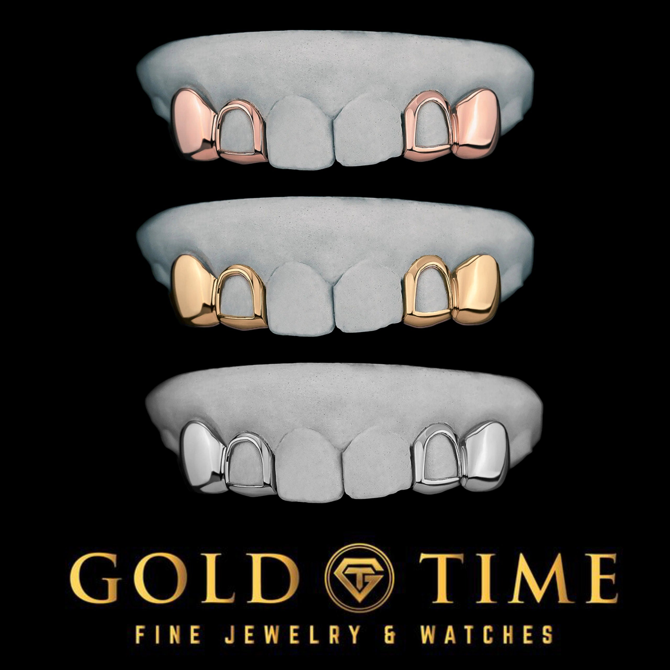 4-Piece Custom Grillz Set  Open Face Incisors & Solid Canines  10K or 14K Gold, Silver  Handmade Grill  Impression Kit Included