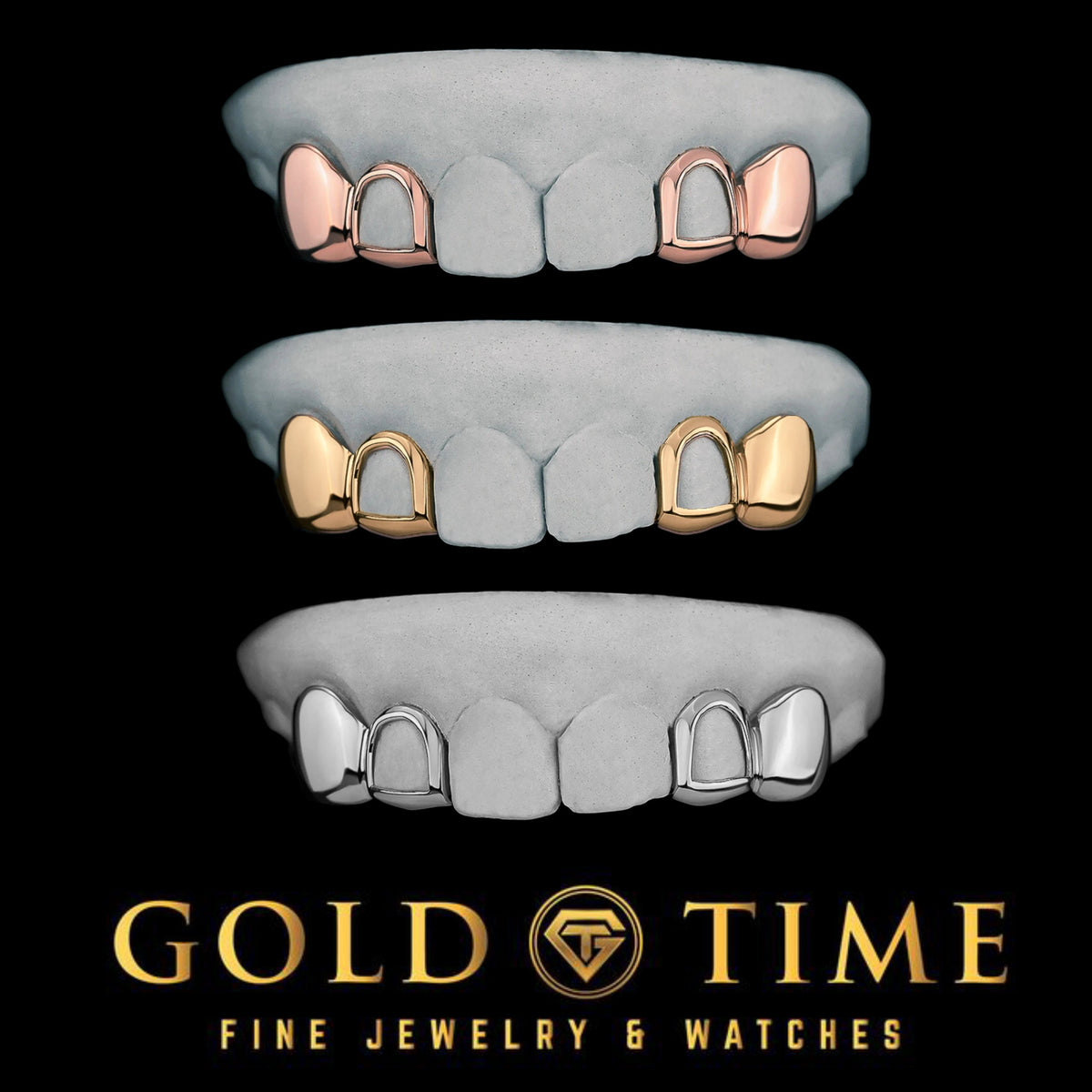 4-Piece Custom Grillz Set  Open Face Incisors & Solid Canines  10K or 14K Gold, Silver  Handmade Grill  Impression Kit Included