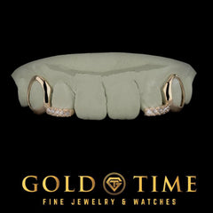 Custom 4 Piece Moissanite Tip Open Face Grillz: Silver, 10K, 14K Gold - Includes Impression Kit