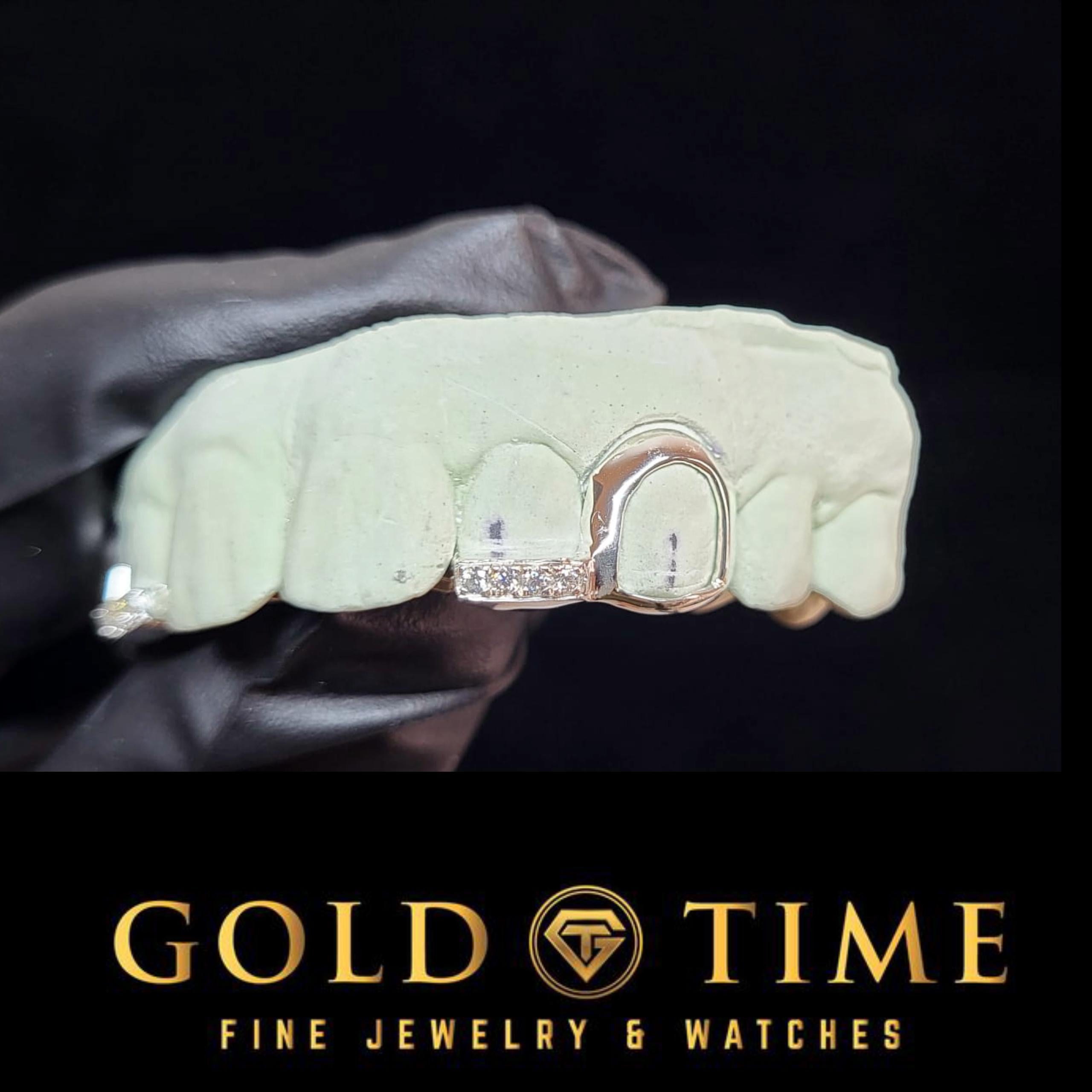 Custom 4 Piece Moissanite Tip Open Face Grillz: Silver, 10K, 14K Gold - Includes Impression Kit