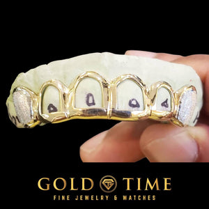 Yellow gold six tooth open face grillz with diamond dust canines, held in the fingers