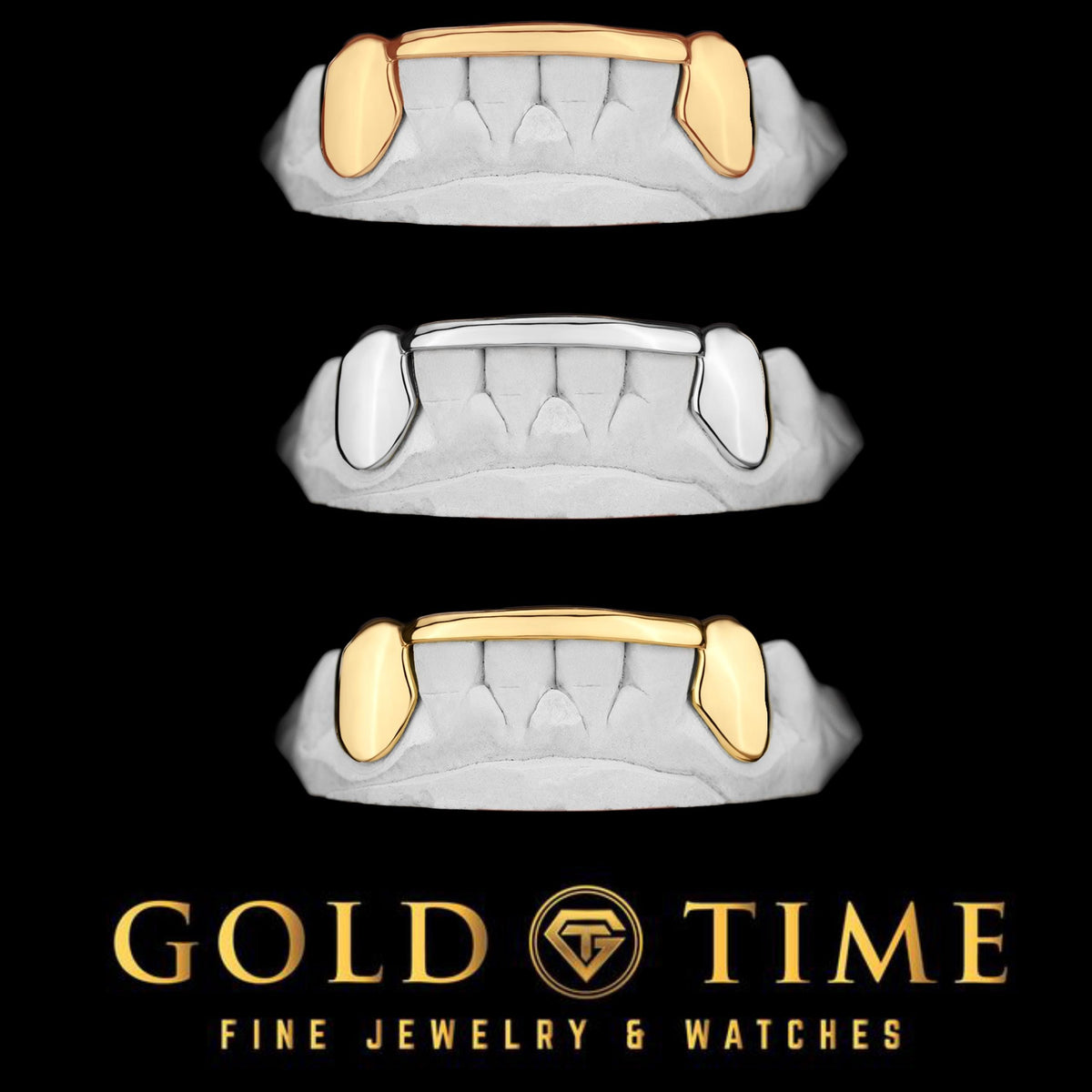 6-Piece Custom Grillz  Solid Canines with Center Tips  Silver, 10K or 14K Gold  Handmade Fit  Impression Kit Included  Luxury Finish