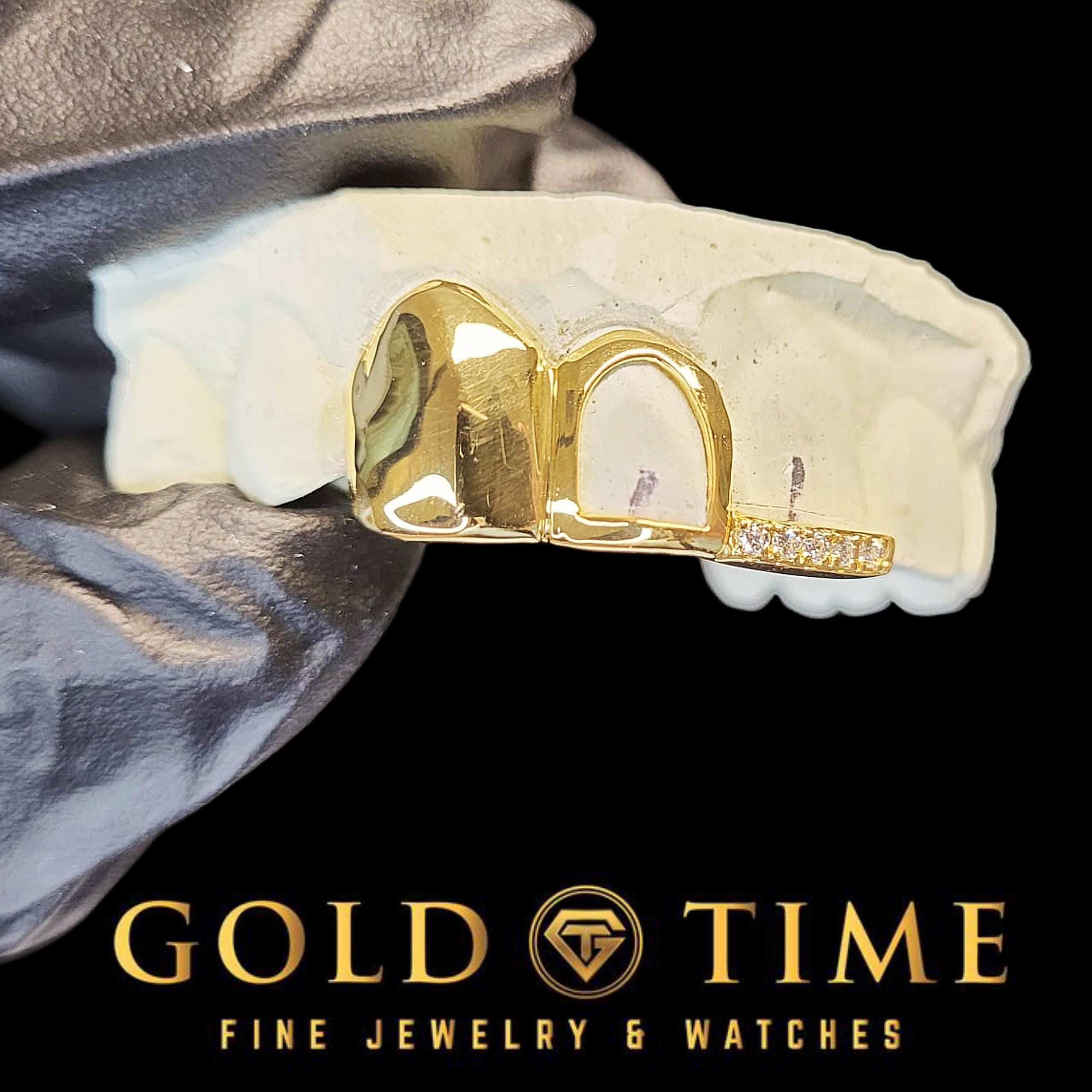 Custom 3-Piece Grillz Set: Solid, Open Face, Moissanite Tip - Includes Mold Kit