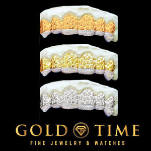 Custom nugget grillz with diamond dust tips in rose, yellow, and white gold