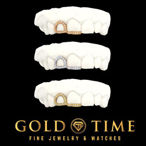Moissanite double cap grillz in rose gold, white gold, and yellow gold with an open face canine outlined in moissanite and an iced incisor tip