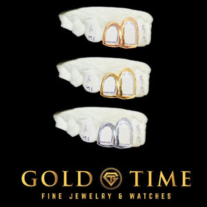 Open face double cap grillz in rose gold, yellow gold and white metal on dental molds, Gold Time