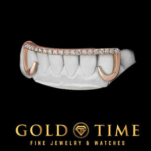 Rose gold open face hooks grillz with moissanite tips on a dental mold