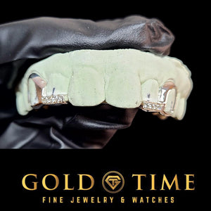 Open face grillz with moissanite tips shown on a dental mold in a gloved hand
