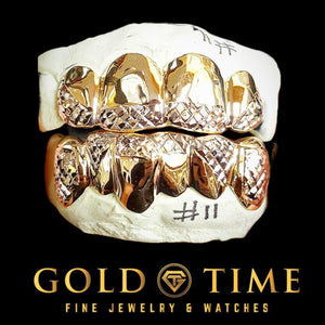 Top and bottom two-tone grillz with polished yellow caps and white diamond-cut tips on a mold