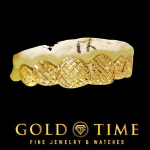 Yellow gold 6 piece trillion cut grillz with diamond dust finish on a dental model