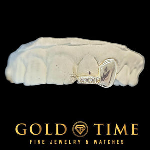 Side view of the solid canine cap and moissanite tip incisor on a dental mold