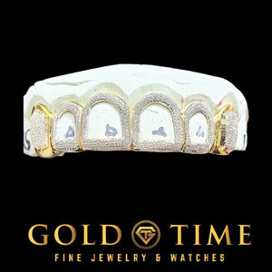 Custom 6 piece open face diamond dust grillz with box canines in white and yellow on a dental mold