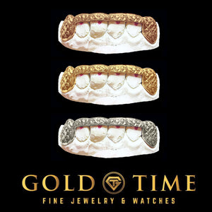 Custom 6 piece trillion cut grillz in rose, yellow, and white gold